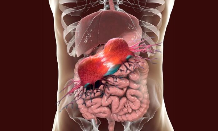 Dostarlimab